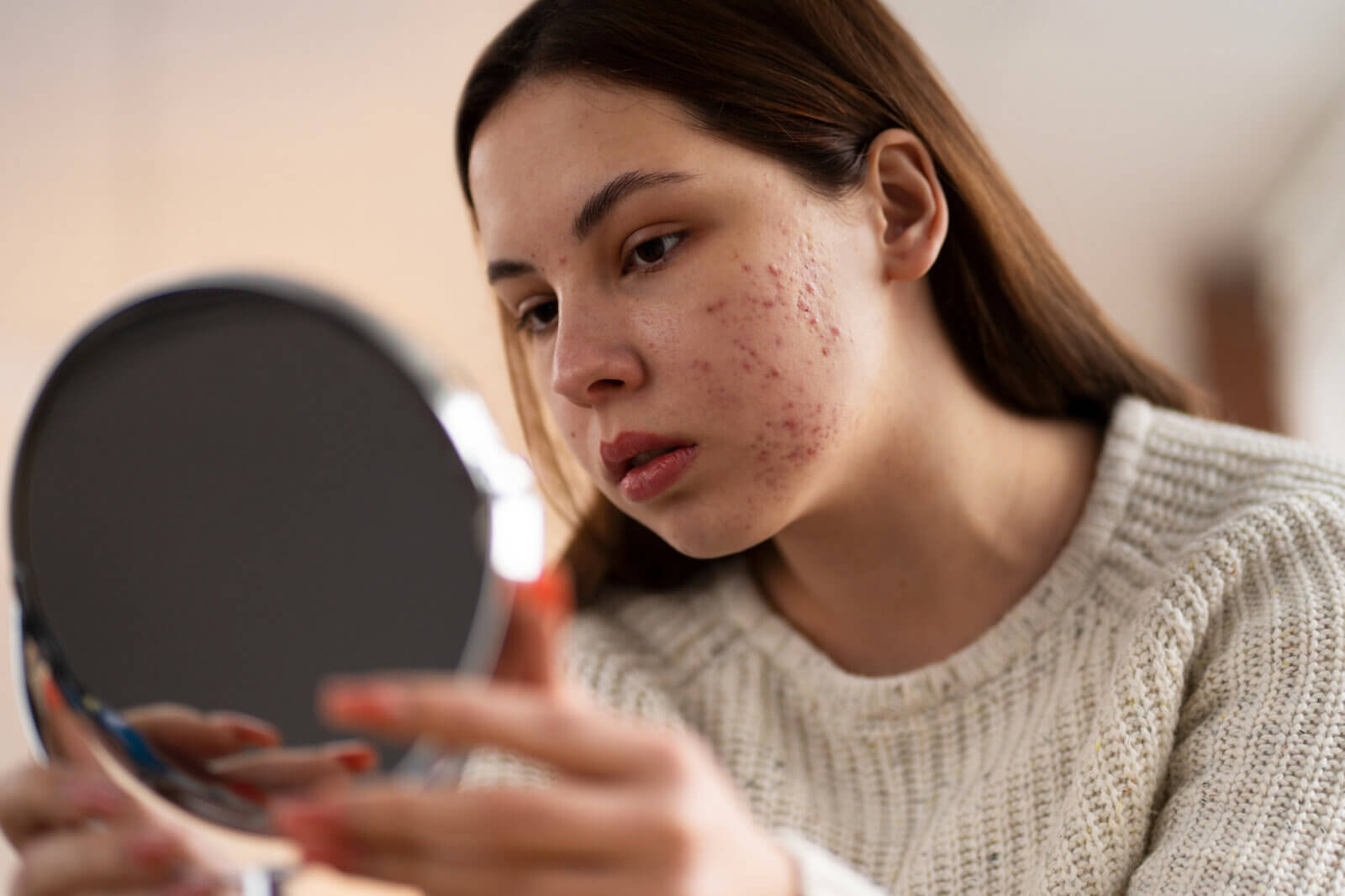 A person dealing with rosacea, representing the rising skin conditions in India.