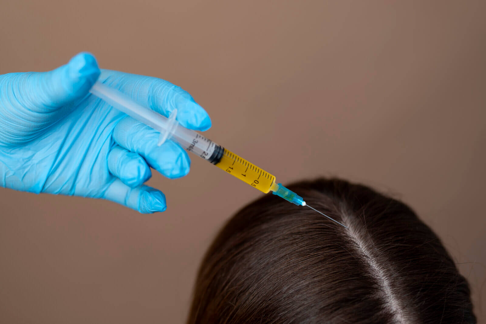 A hand administering an injection to a patient's scalp during a natural-looking aesthetics procedure