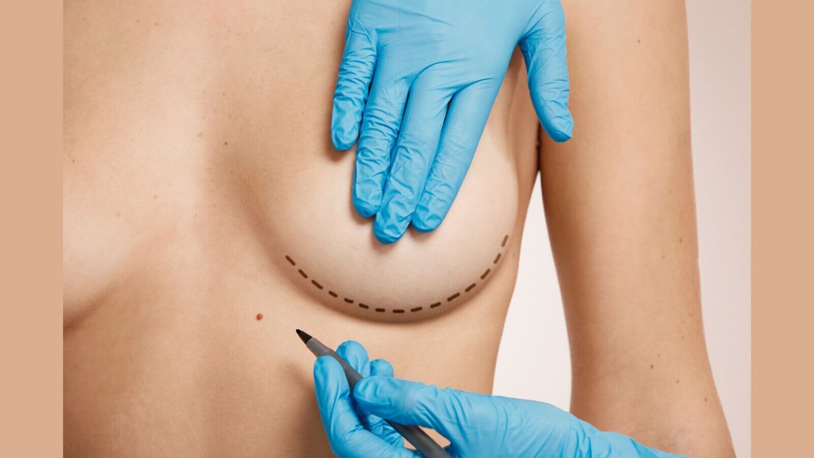 Breast Reduction Surgery The Hidden Benefits Beyond Beauty