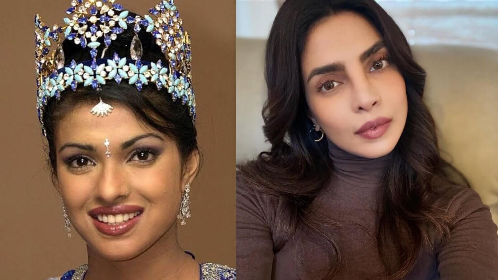 Celebrity Rhinoplasty Surgery Takes Center Stage in Aesthetic Trends