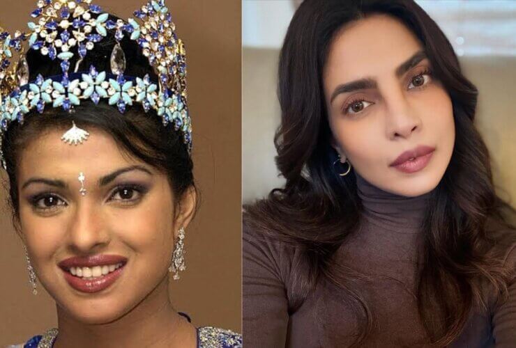 Celebrity Rhinoplasty Surgery Takes Center Stage in Aesthetic Trends