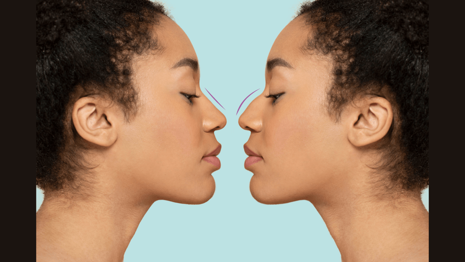 Nose Reconstruction Market Soars—$6.1B by 2030!