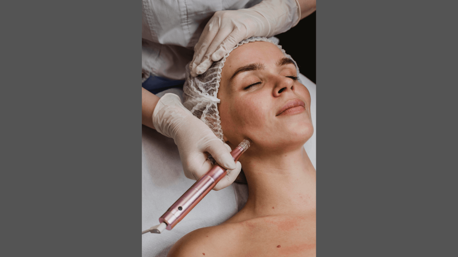Microdermabrasion Market Grows with AI, Tech, and Self-Care Trends
