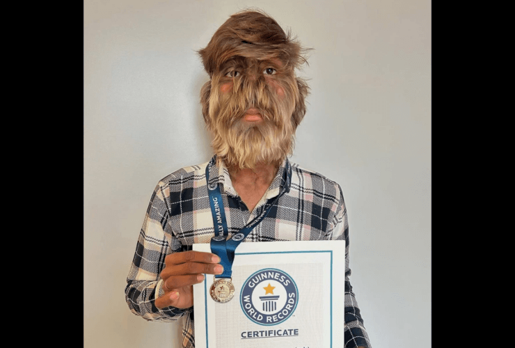 Lalit Patidar sets Guinness record for hairiest face