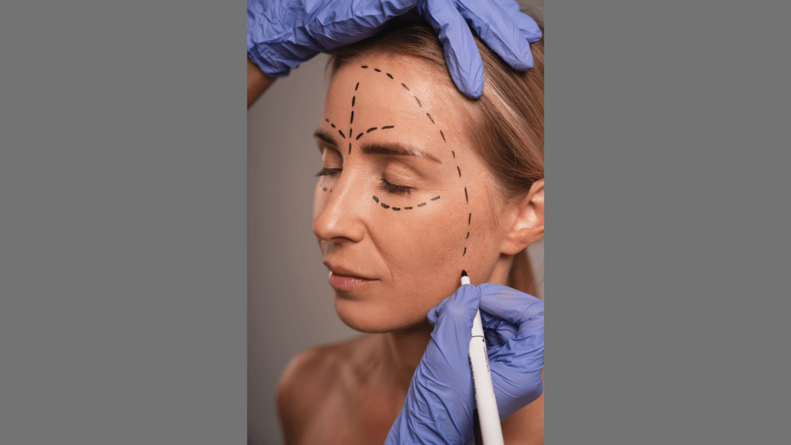 IIndia plastic surgery market poised to lead the world