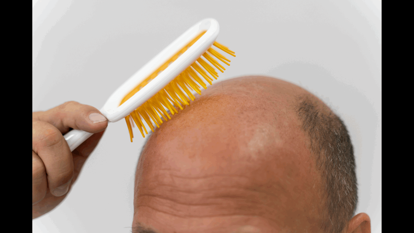 Scientists unlock hair growth with molecular signals