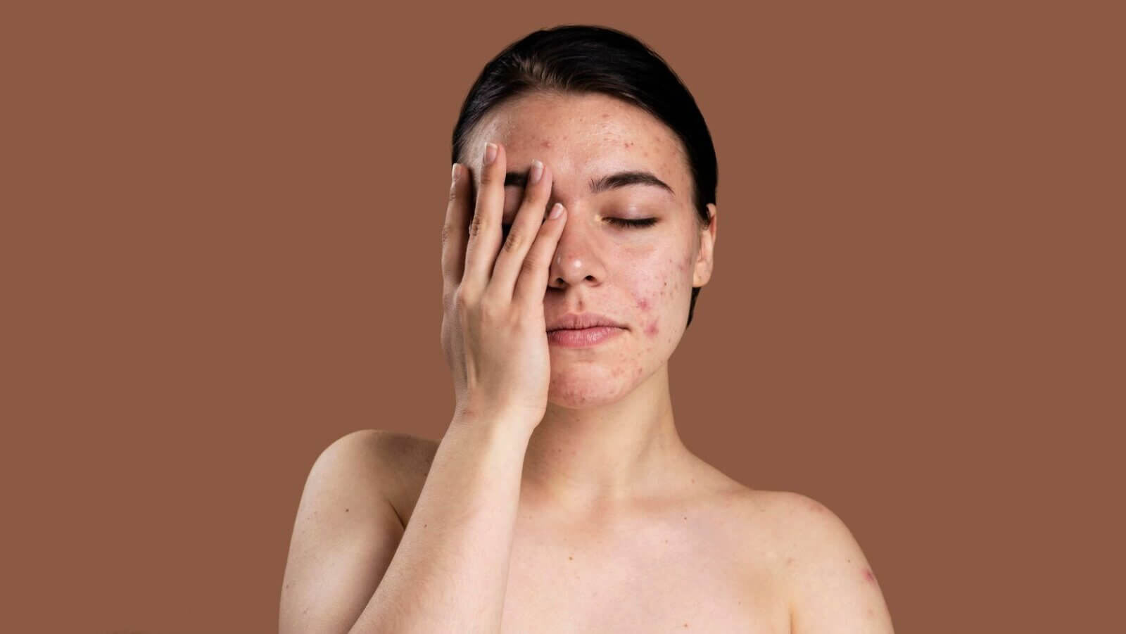 Read how sensitive skin affects 70% globally and explore Galderma’s latest research, treatments, and innovations in dermatology care.