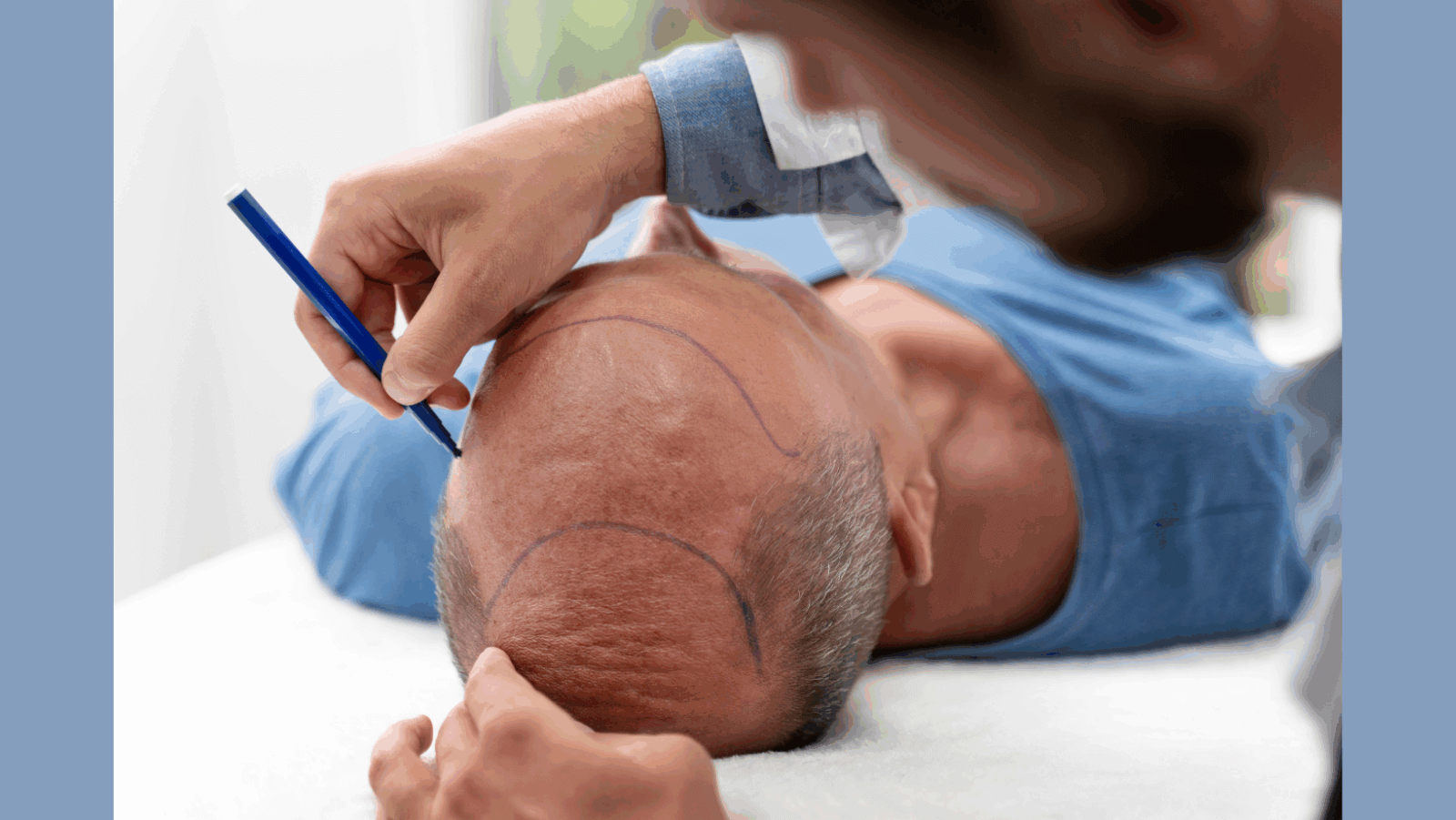 India hair restoration: Why subtle procedures drive men wellness