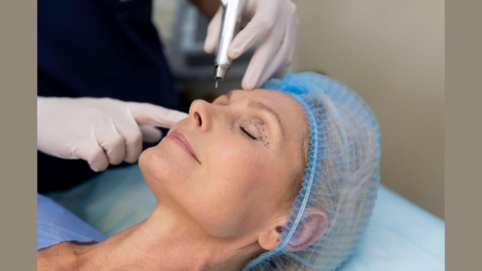 Blepharoplasty emerges as key a trend in 2026