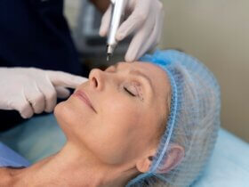 Blepharoplasty emerges as key a trend in 2026