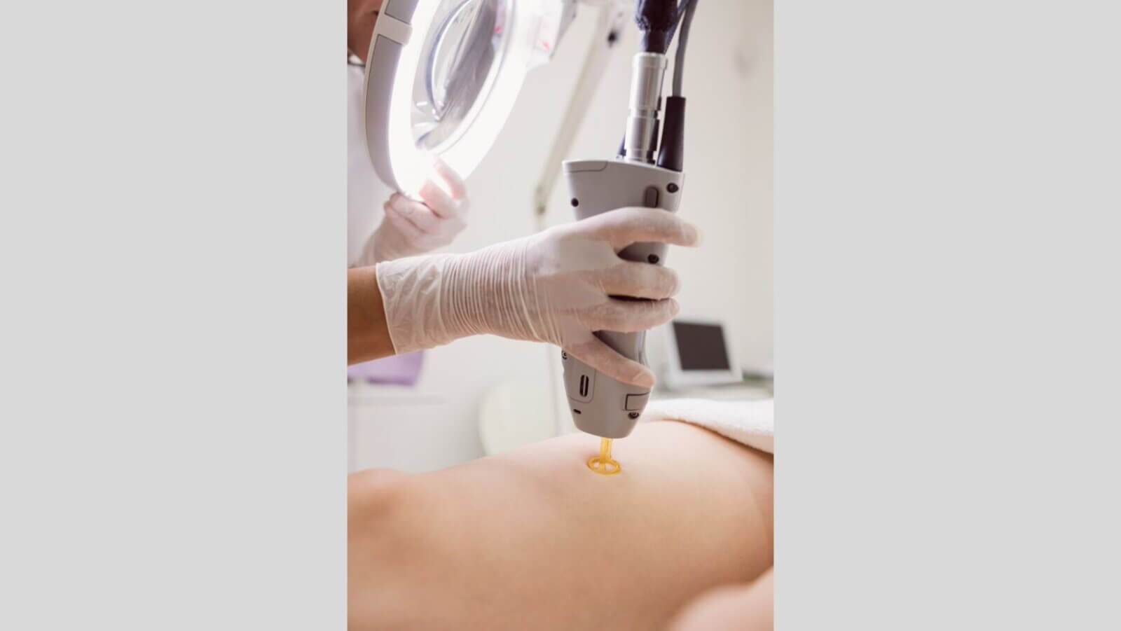 Laser-assisted liposuction market to hit $4.64B by 2033