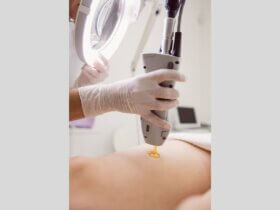 Laser-assisted liposuction market to hit $4.64B by 2033
