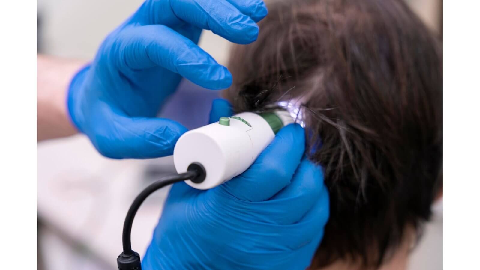 Hair regeneration advances with biology-focused treatments