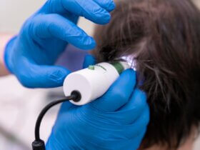 Hair regeneration advances with biology-focused treatments