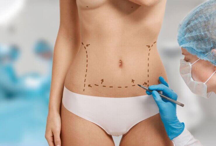 Tummy-tuck surgery eases back pain and urinary incontinence