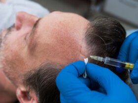 CRLAB and Hairline International launch non-surgical hair solutions