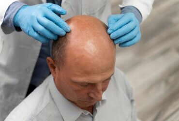 Cosmo reports strong long-term hair loss treatment results