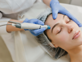 Microneedling with TXA shows promise for melasma