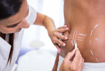 Non-invasive body contouring gains momentum