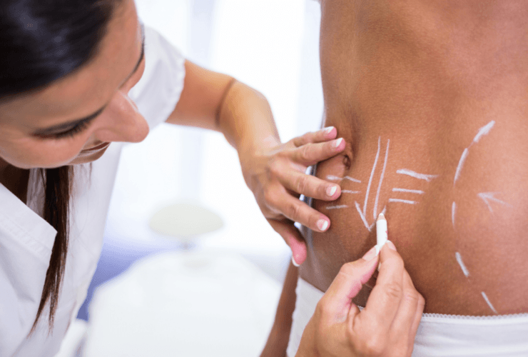 Non-invasive body contouring gains momentum