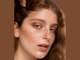 Facial hyperpigmentation: New review urges broader approach