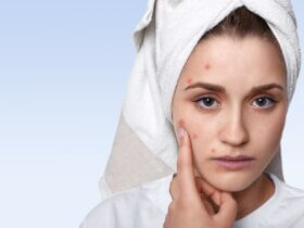 Acne treatment shifts toward personalised care models