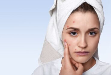 Acne treatment shifts toward personalised care models