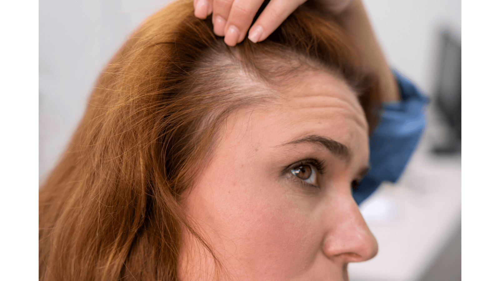 Dr M. D. Sindhura: Diagnosis key in hair loss treatment
