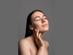 Body acne cases surge in Bengaluru amid rising heat