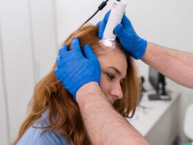 Precision signalling shapes future of hair restoration