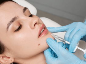 Dermal fillers market set for strong global growth