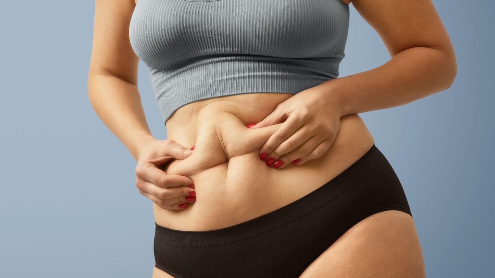 Tummy tuck gains demand beyond weight loss