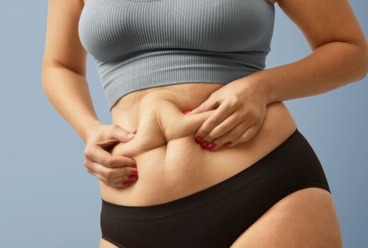 Tummy tuck gains demand beyond weight loss