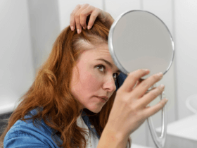 Start-ups target early hair loss market as Gen Z demand rises