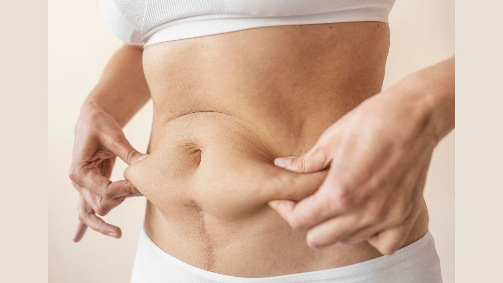 Mommy makeovers gain traction among women after childbirth