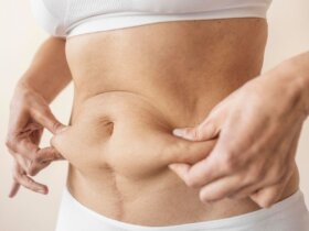 Mommy makeovers gain traction among women after childbirth