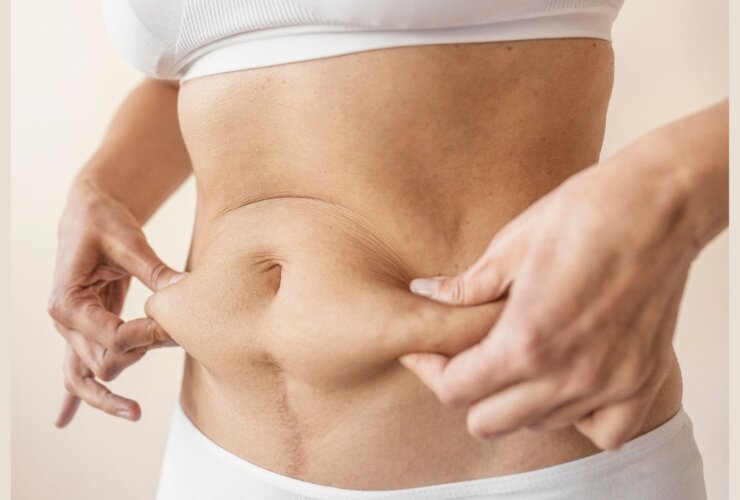 Mommy makeovers gain traction among women after childbirth