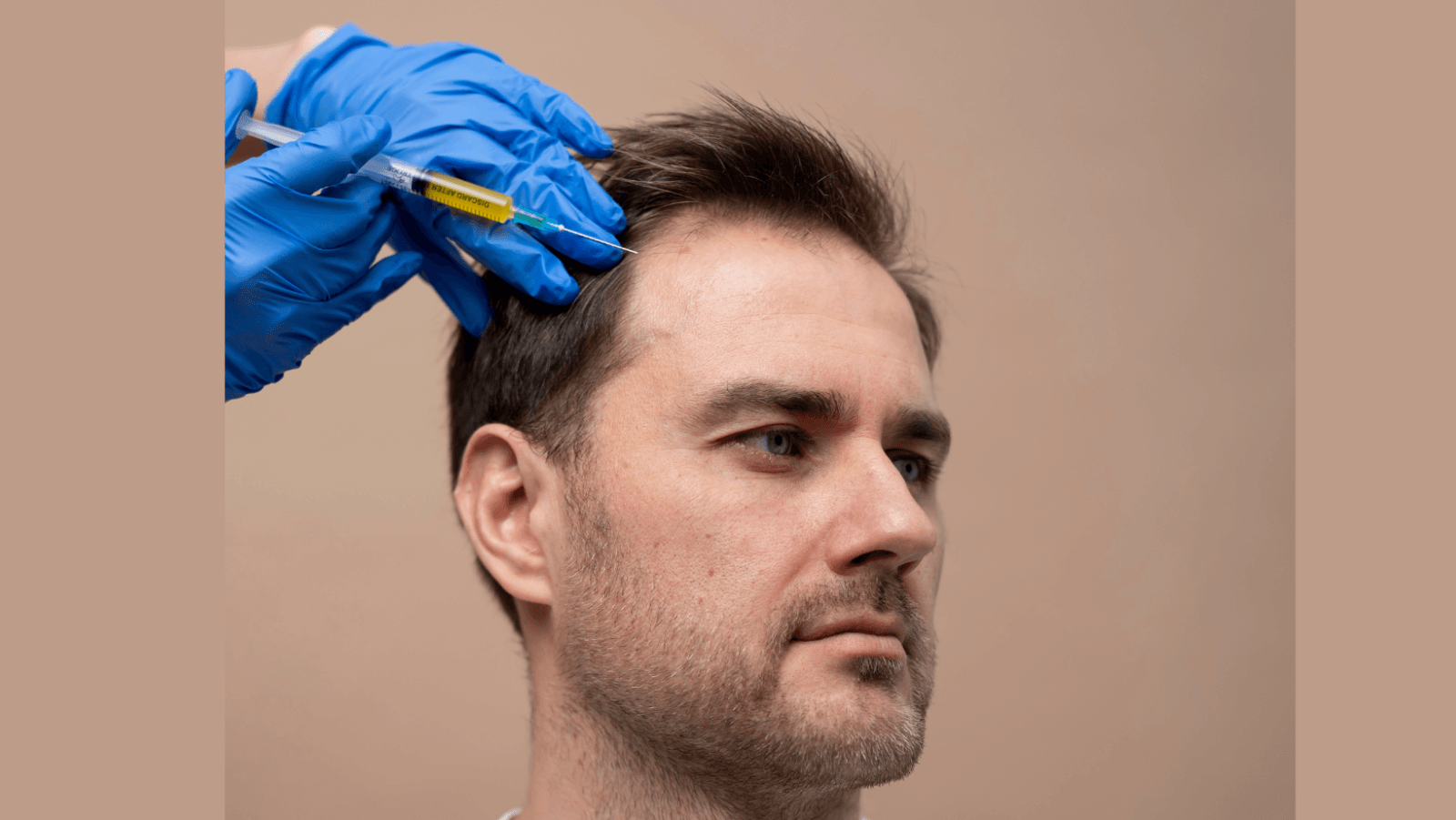 Hair restoration market set for sustained growth through 2030