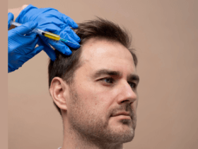 Hair restoration market set for sustained growth through 2030